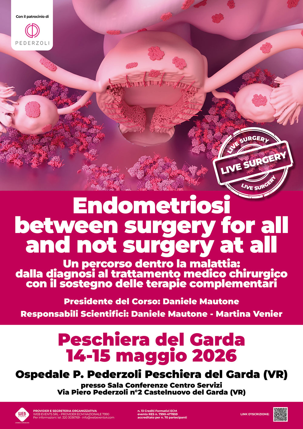 Endometriosi “Between Surgery for all and not surgery at all” - Un percorso dentro la malattia: dalla diagnosi al trattamento medico chirurgico con il sostegno delle terapie complementari