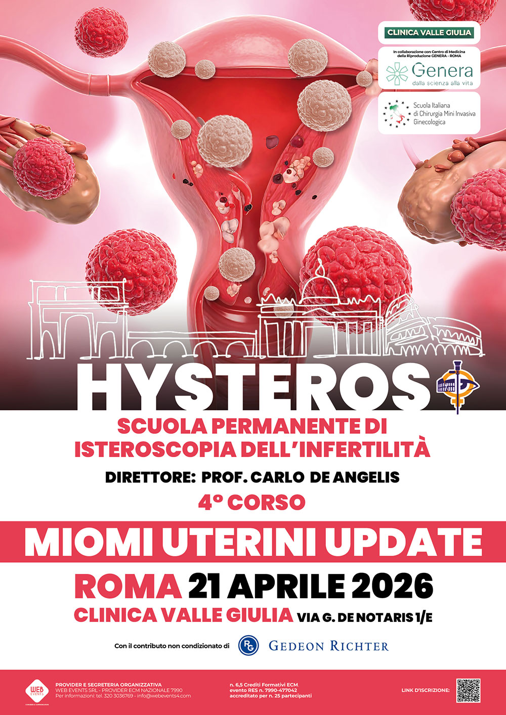 IV CORSO SCUOLA DI ISTEROSCOPIA DELL’INFERTILITA’  “HYSTEROS”  MIOMI UTERINI UPDATE